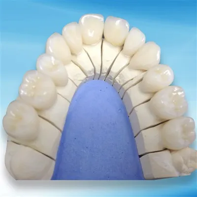 歯科用ジルコニアのメンテナンス要件は何ですか?