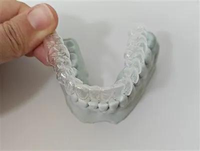 透明リテイナーはどのように機能しますか?