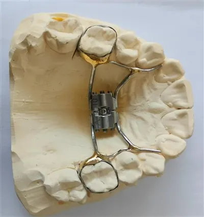 取り外し可能な義肢に関する研究はありますか?